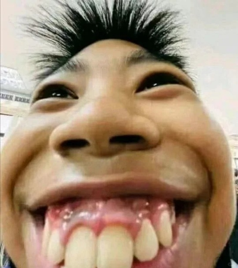 trai xấu meme với nụ cười rộng quá mức, hiệu ứng gây cười.